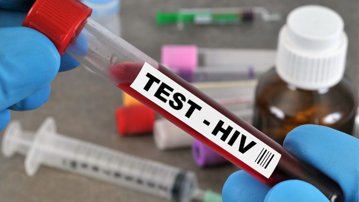 Peste 880 de moldoveni au aflat în 2024 că trăiesc cu HIV: autoritățile trag un semnal de alarmă