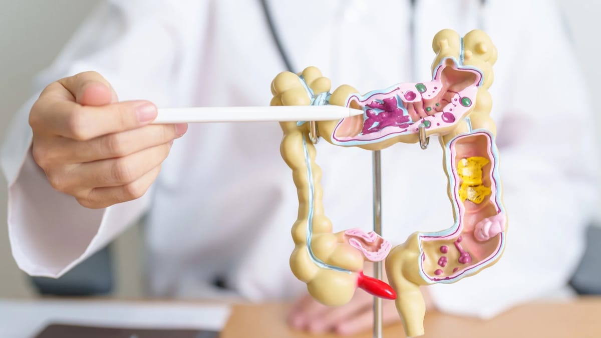 Mii de persoane din R. Moldova au făcut screening pentru cancerul colorectal în 2025