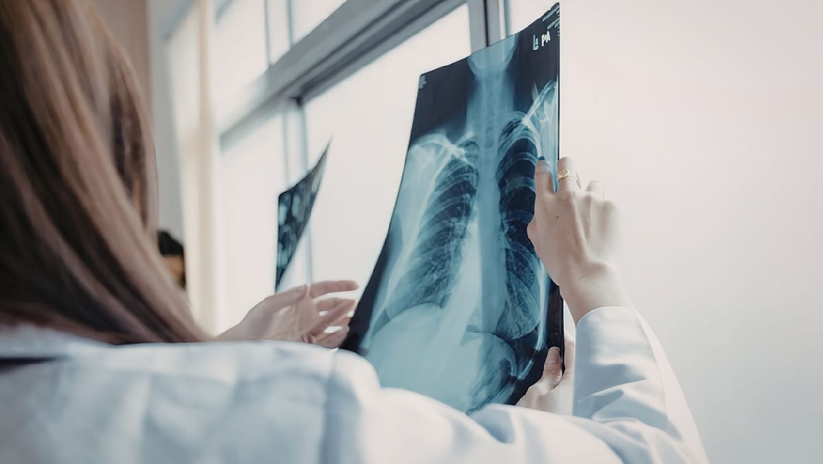 Consultații pulmonare gratuite în raionul Hîncești. Unde va ajunge echipa mobilă de medici în aceste zile