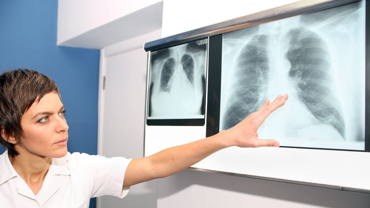 Consultații gratuite la Ialoveni: Complexul radiodiagnostic mobil ajunge în trei localități pentru screening pulmonar