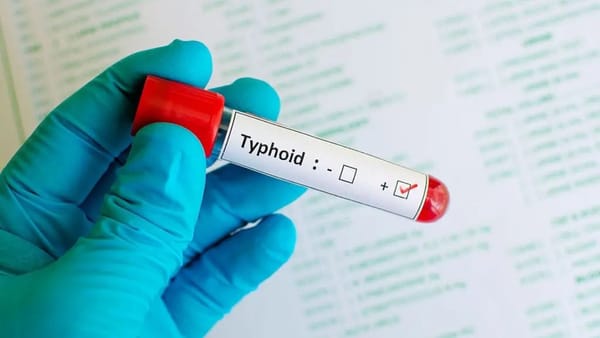 Caz de febră tifoidă, înregistrat în R. Moldova. Pacientul a revenit recent din Nigeria