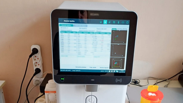 Laboratorul Centrului de Sănătate Sîngerei, modernizat cu echipamente medicale performante