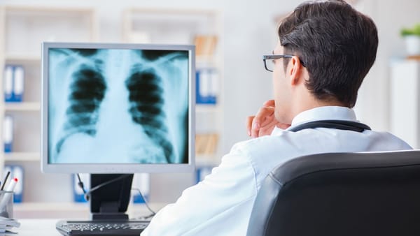 Screening pulmonar gratuit în raionul Hâncești. Unde va ajunge complexul radiodiagnostic mobil