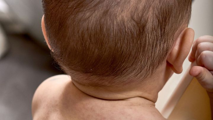 De la începutul lunii februarie, în capitală au fost raportate peste 90 de cazuri de rujeolă
